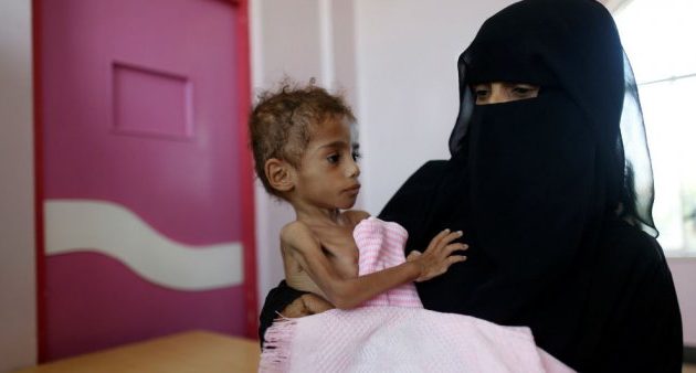 Unicef dice que la guerra en Yemen es contra los niños