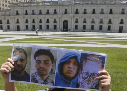 Ofician al Minsal por presuntas negligencias en programa de reparación a heridos oculares