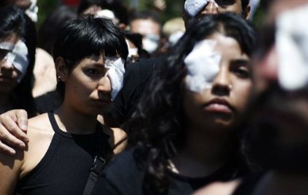 Víctimas de trauma ocular y Ley Gatillo Fácil: “Envalentona a Carabineros a disparar a destajo, sin miedo a consecuencia”